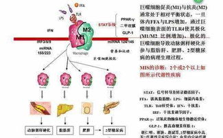 糖尿病与心脑血管疾病是一类疾病,了解一下常用相关中成药很重要